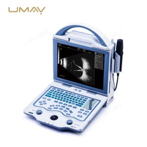 Popular Model High-Frequency Ophthalmic Ultrasound A B Scan-5