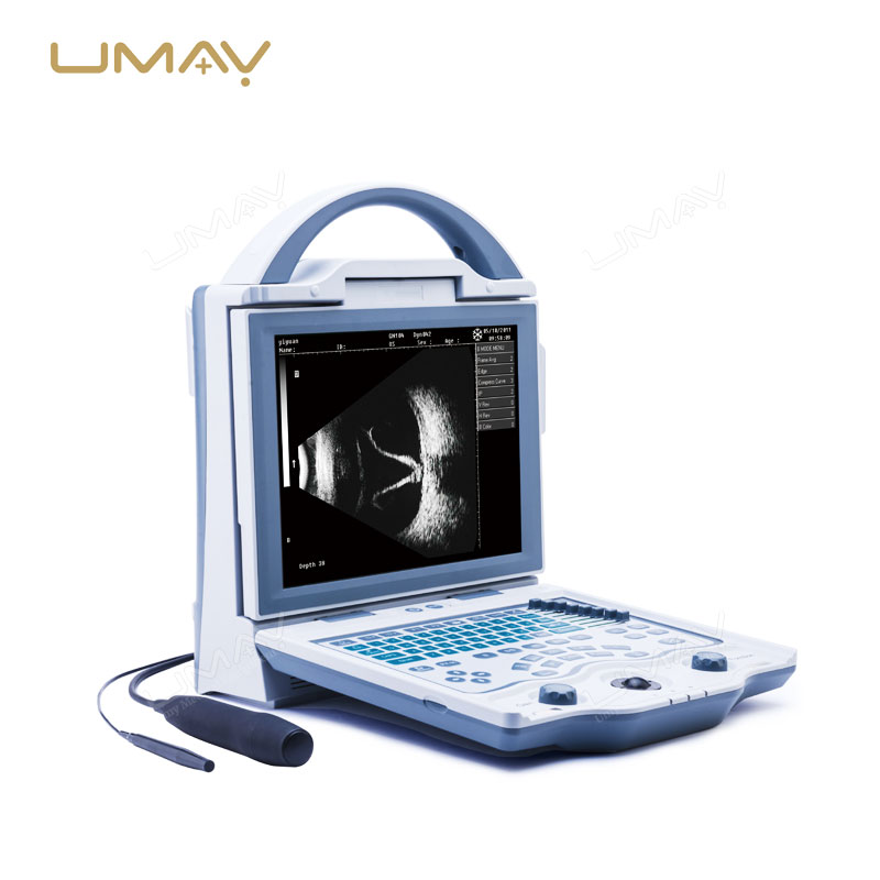 Popular Model High-Frequency Ophthalmic Ultrasound A/B Scan