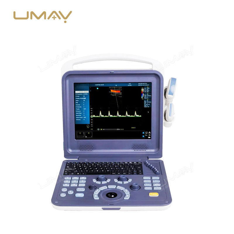 Portable 3D/4D Color Doppler Ultrasound Scanner for Obstetrics, Cardiology, and Abdominal Diagnostics