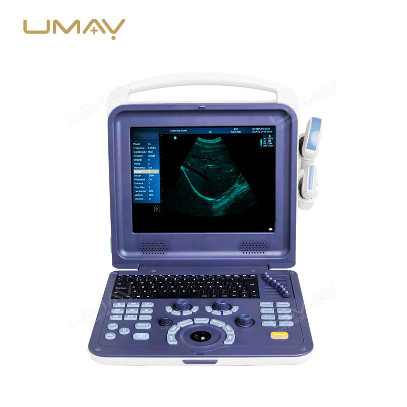 Portable 3D/4D Color Doppler Ultrasound Scanner for Obstetrics, Cardiology, and Abdominal Diagnostics