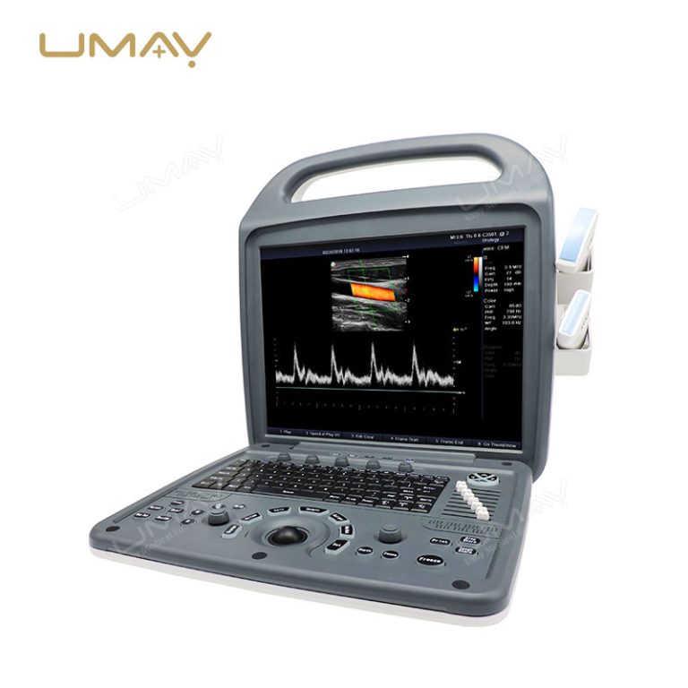 Portable Full Digital Color Doppler Ultrasound Diagnostic Instrument with Ultra-Clear Imaging