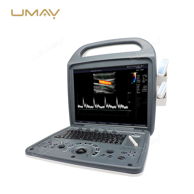 Portable Full Digital Color Doppler Ultrasound Diagnostic Instrument with Ultra-Clear Imaging