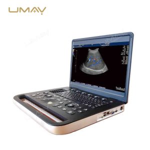 Portable Laptop Color Doppler Ultrasound Machine for Small Hospitals and Community Clinics-2