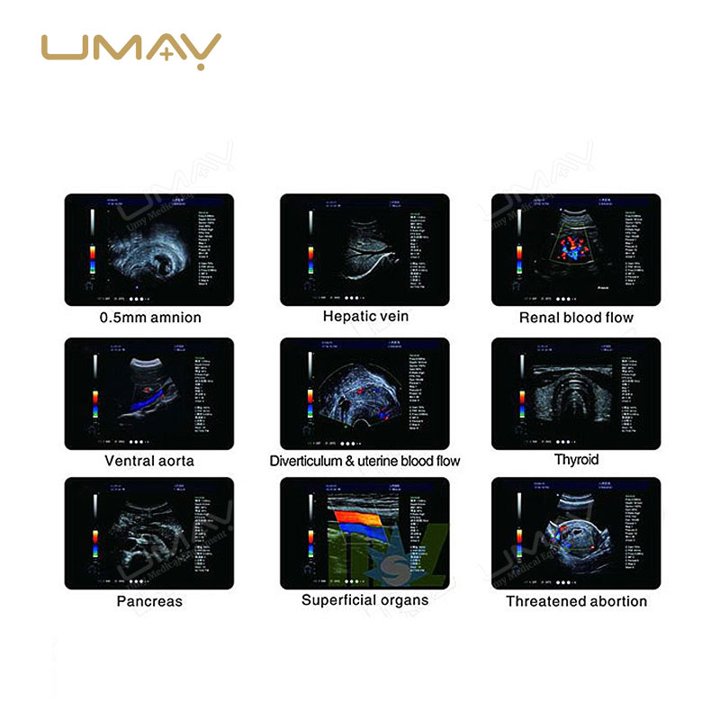 Trolley-Based 4D Full Digital Color Doppler Ultrasound Diagnostic Machine