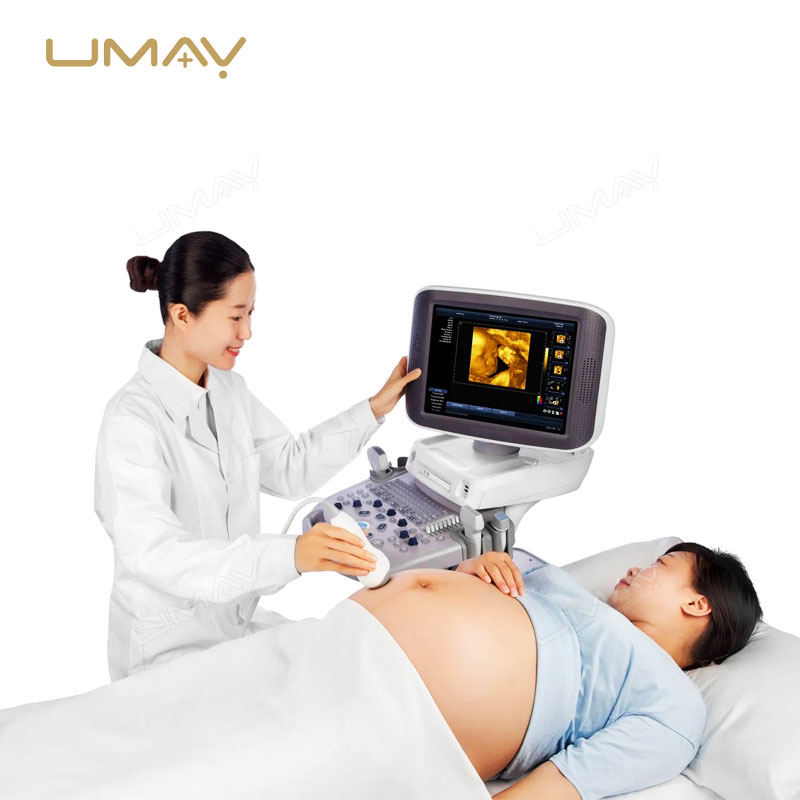 Trolley-Based Digital Diagnostic Ultrasound System with Color Doppler