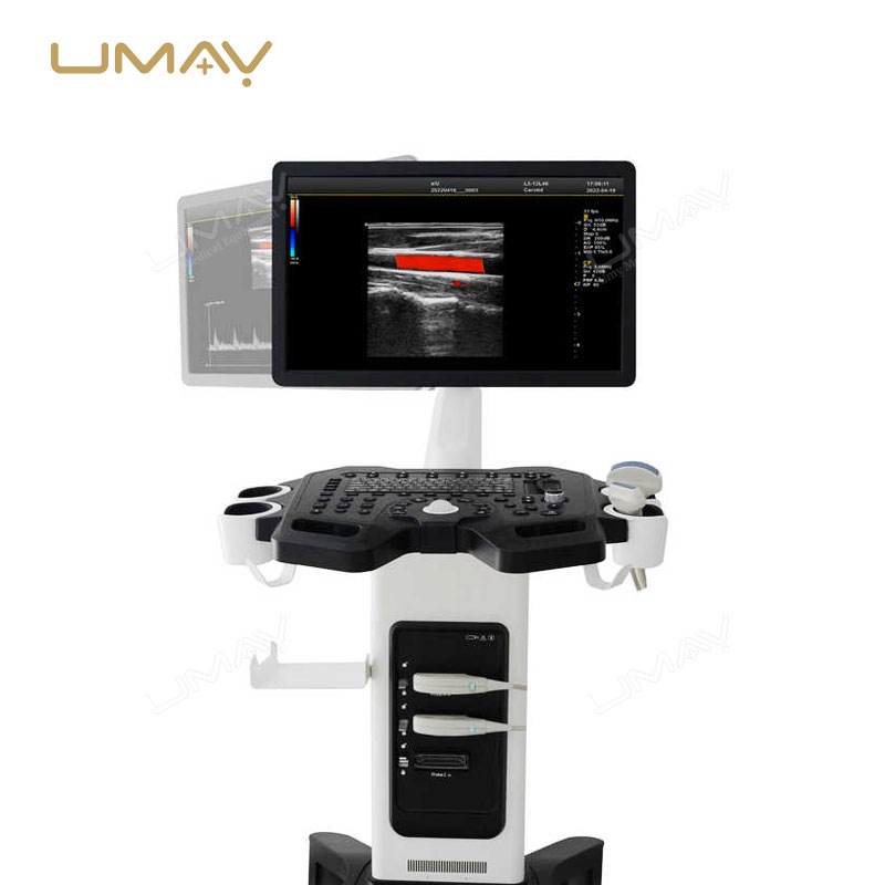 Trolley Color Doppler Ultrasound Machine with 21.5-Inch Medical-Grade High-Definition LCD Display