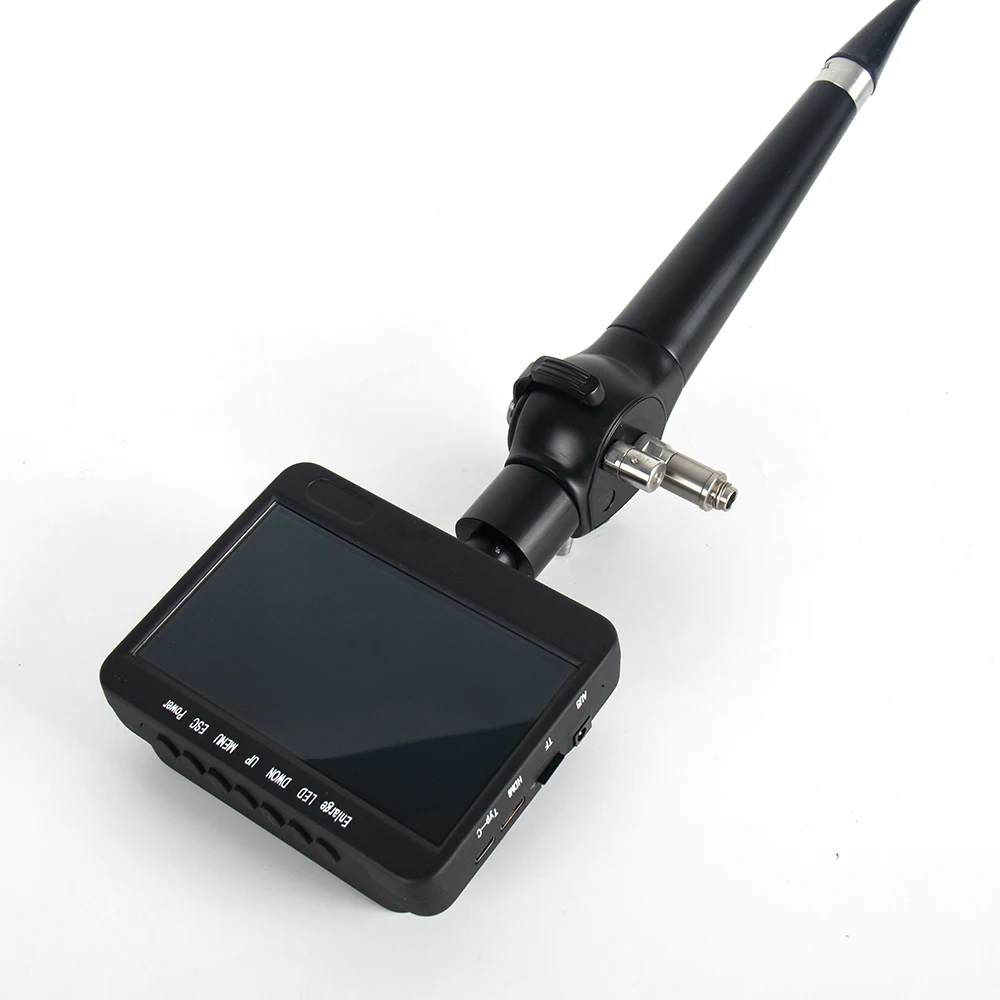 Portable Flexible Video Endoscope with High-Resolution Display for Choledochoscopy