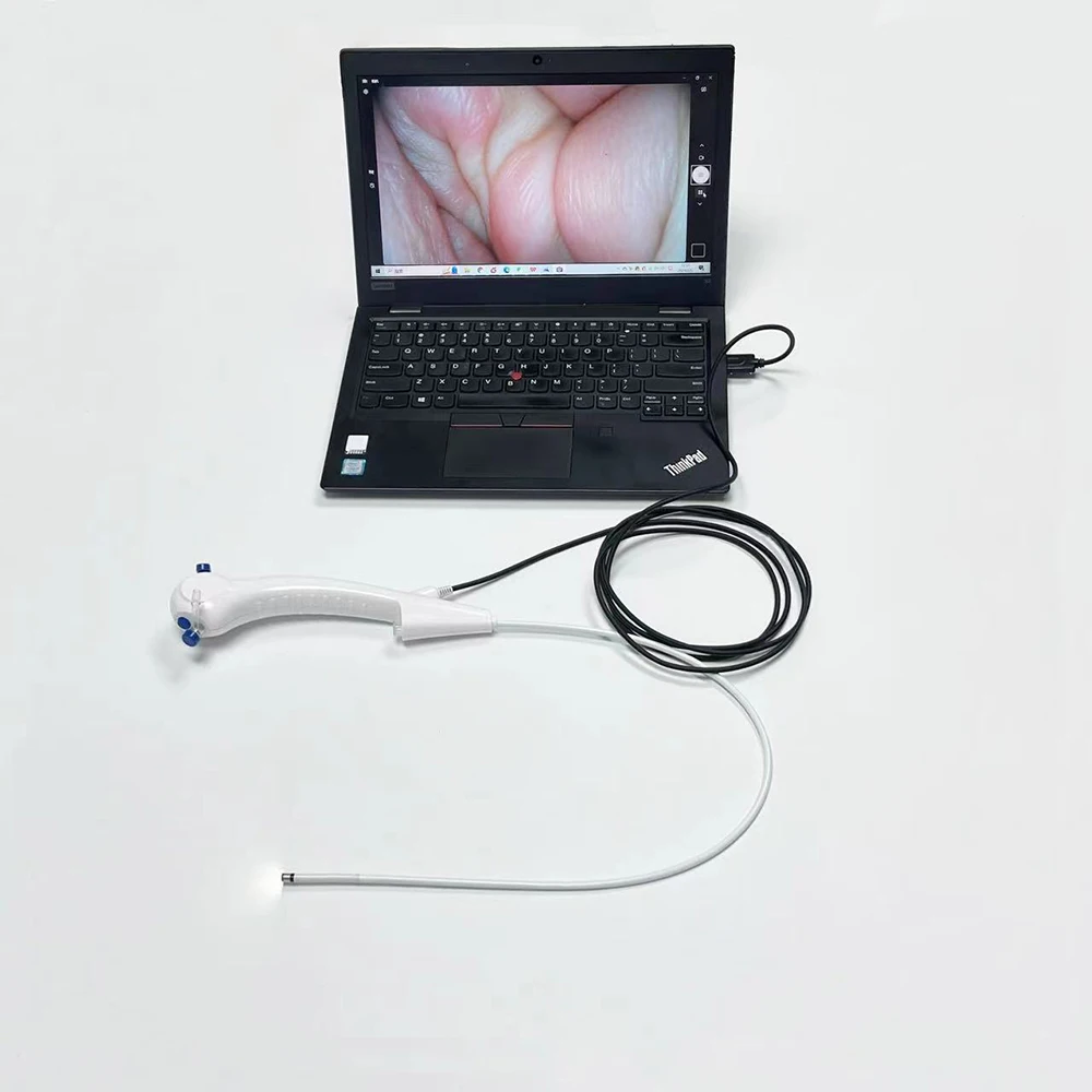 Portable Disposable Flexible Video Ureteroscope with 10-Inch Touch Screen