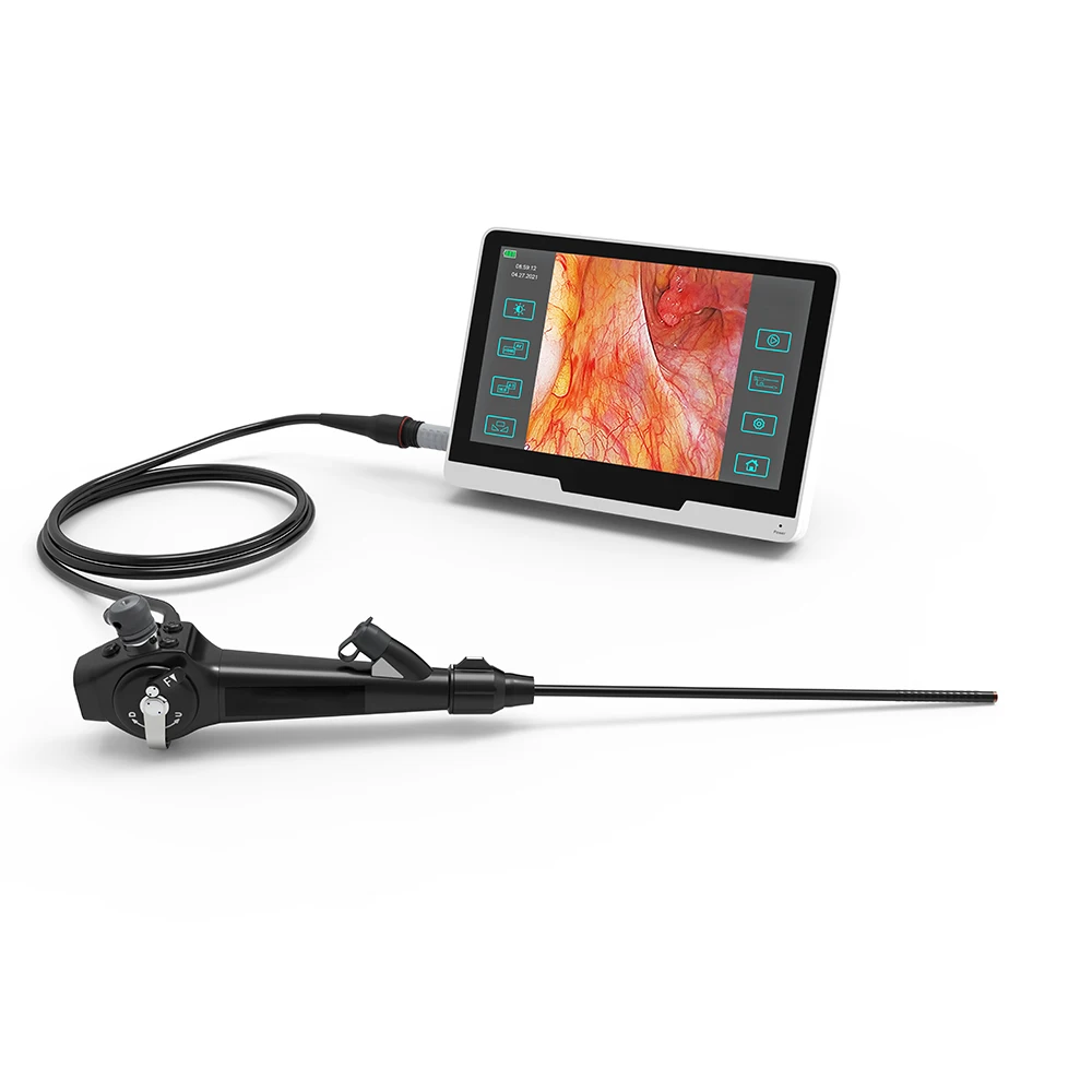 Portable Handheld Touch Screen Pleuroscope with Budget-Friendly Pricing