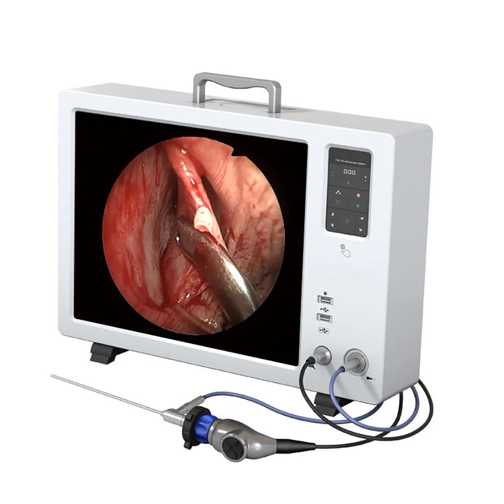 Portable Full HD Endoscope Camera System with 19-Inch Monitor and Cold Light Source