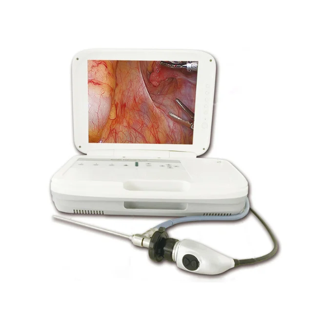 Full HD Medical Endoscope Camera with Large Color Screen for High-Resolution Imaging