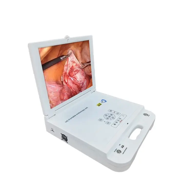 Portable Full HD Medical Video Endoscope Camera System for ENT, Urology, and Laparoscopy with Integrated 80W LED Light Source