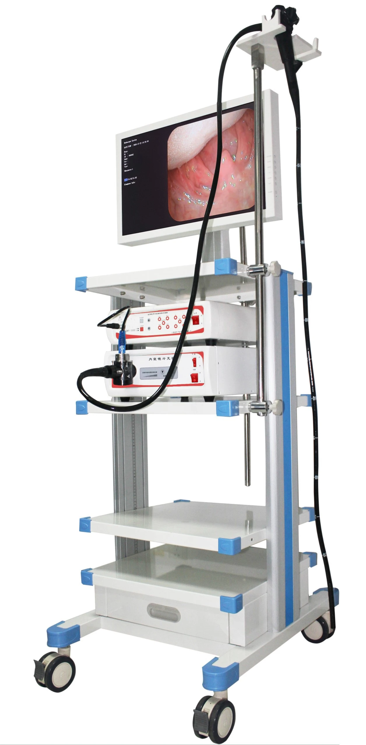 Trolley Endoscope System with Video Gastroscope and Video Colonoscope