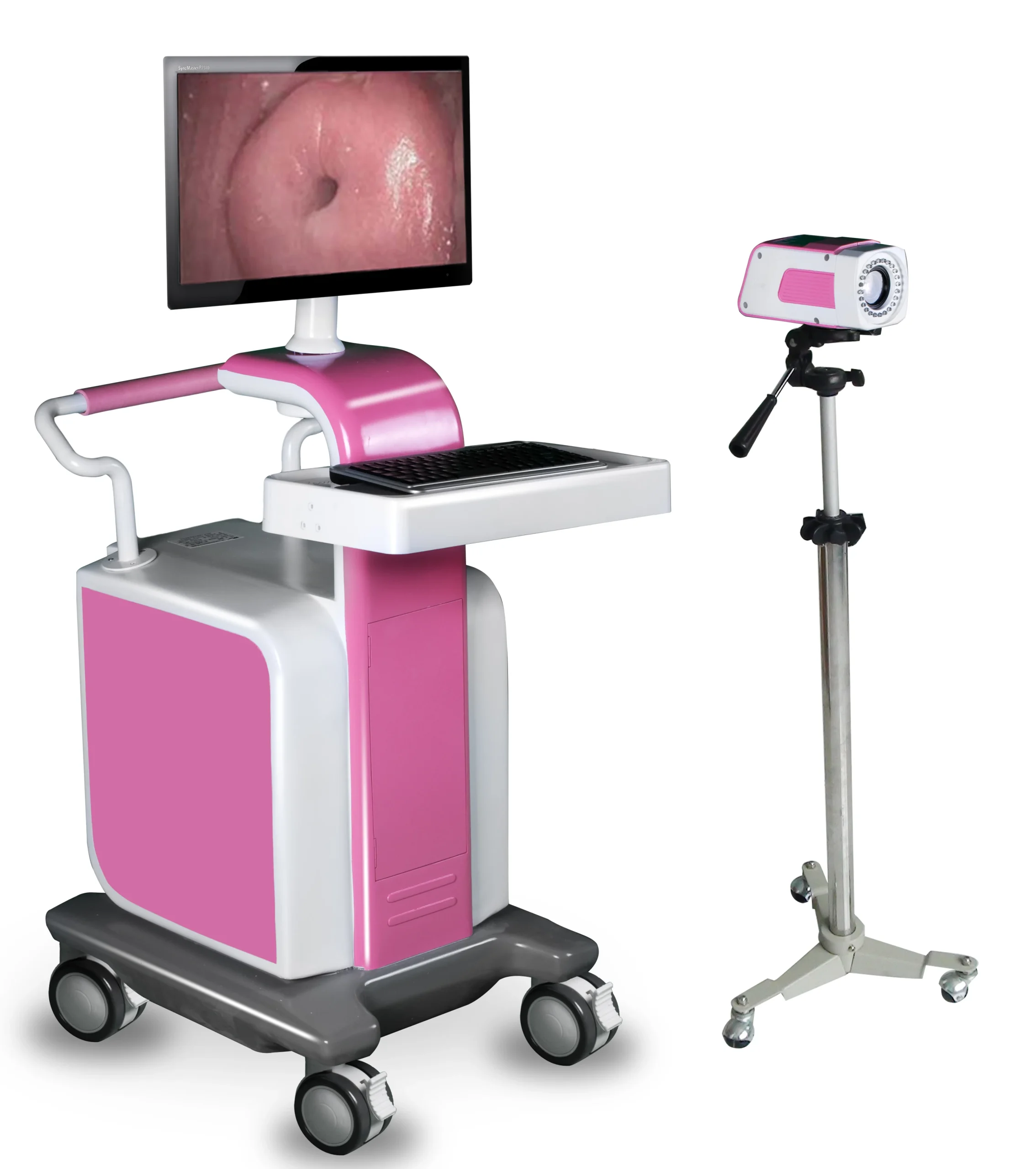 Trolley-Type Digital Optical Medical Endoscopy Video Colposcope with HD Camera for Gynecology Clinics and Hospitals