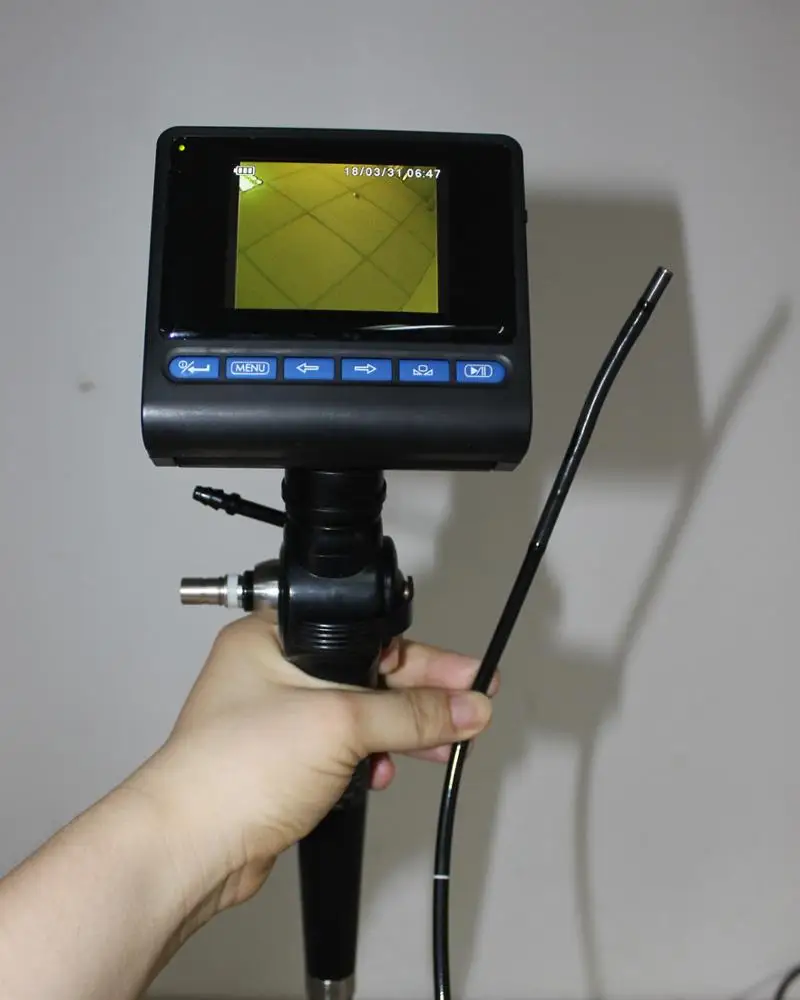 Mobile Airway Fiber Video Endoscope - Airway Mobilescope