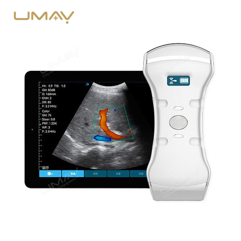 Handheld Color Doppler Ultrasound Machine with 3-in-1 Probes for Elite Image Definition