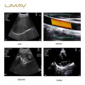 Handheld Color Doppler Ultrasound Machine with 3-in-1 Probes for Elite Image Definition-5