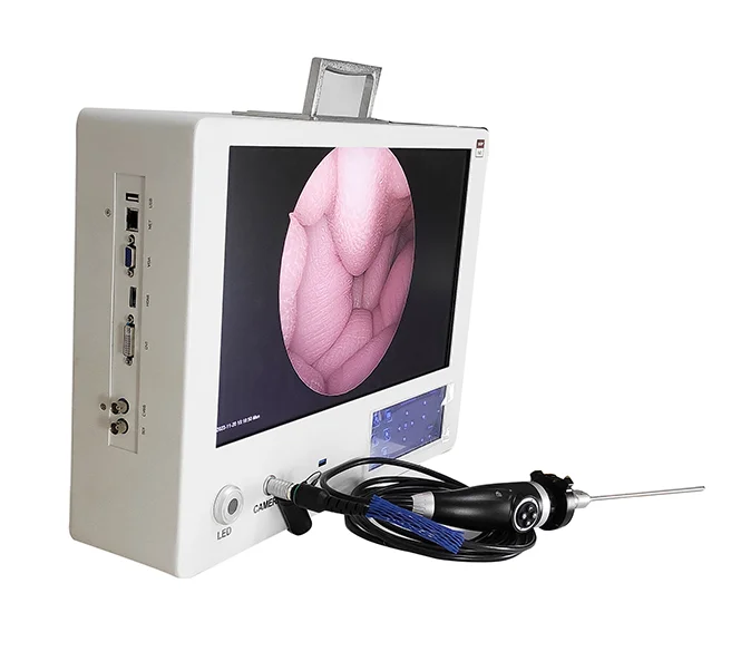 Portable Endoscope Camera System with Economy-Driven Design