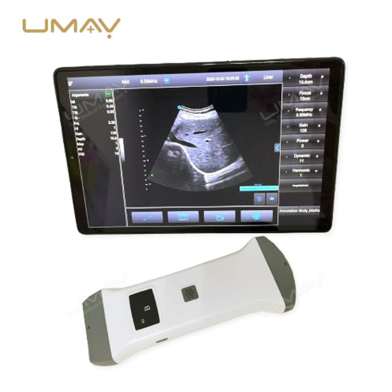 Portable Color Doppler Ultrasound Machine with 24 Channels for High-Precision Imaging-4