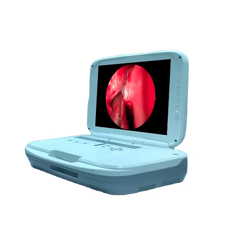 Portable High-Definition Endoscope Camera System with Advanced Image Sharpness